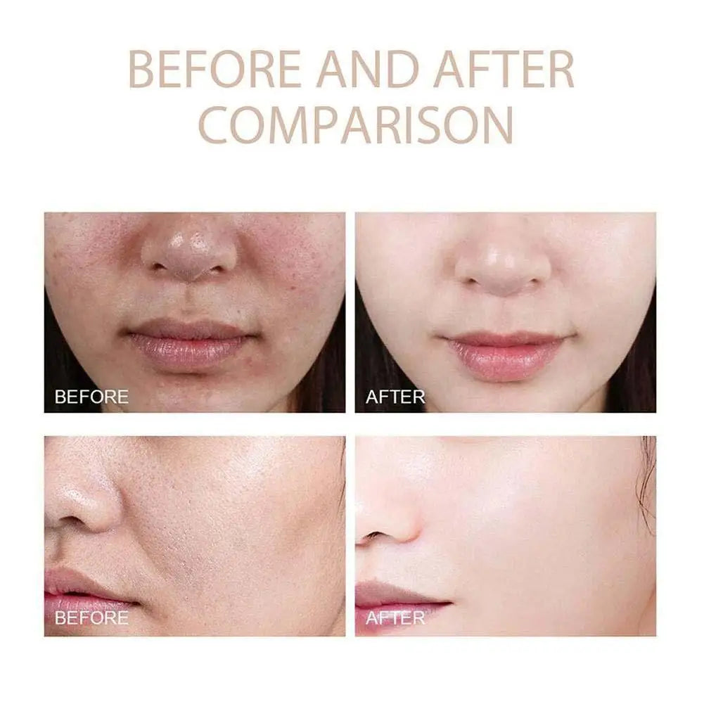 Korean Dr. Melaxin Rice Exfoliating Serum & Facial Care Kit - Moisturizing Stick, Anti-Wrinkle Eye Cream Cleanser Skin care