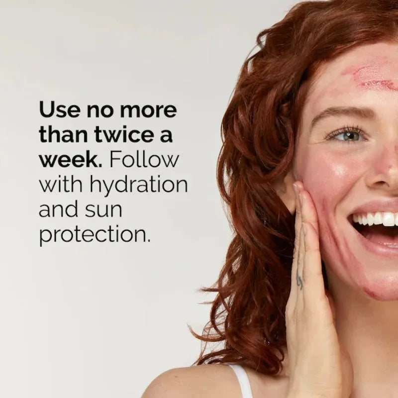 AHA 30%+BHA 2% Peeling Solution 30ml Multi Effect Peeling Solution Exfoliating Facial Brighten Smooth Refine Appearance Of Skin