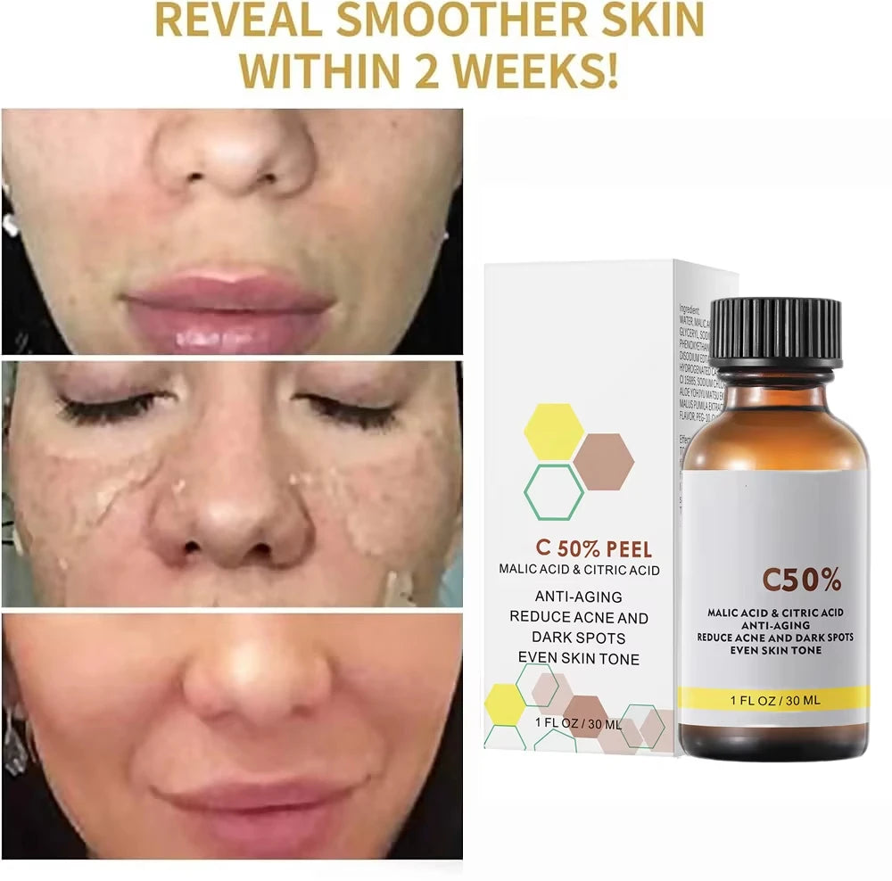 Face Care Exfoliating Radiant Skin Fade Dark Spots & Pigmentation for Even Brighter Skin Remove Spots Arm Knee Legs Melanin