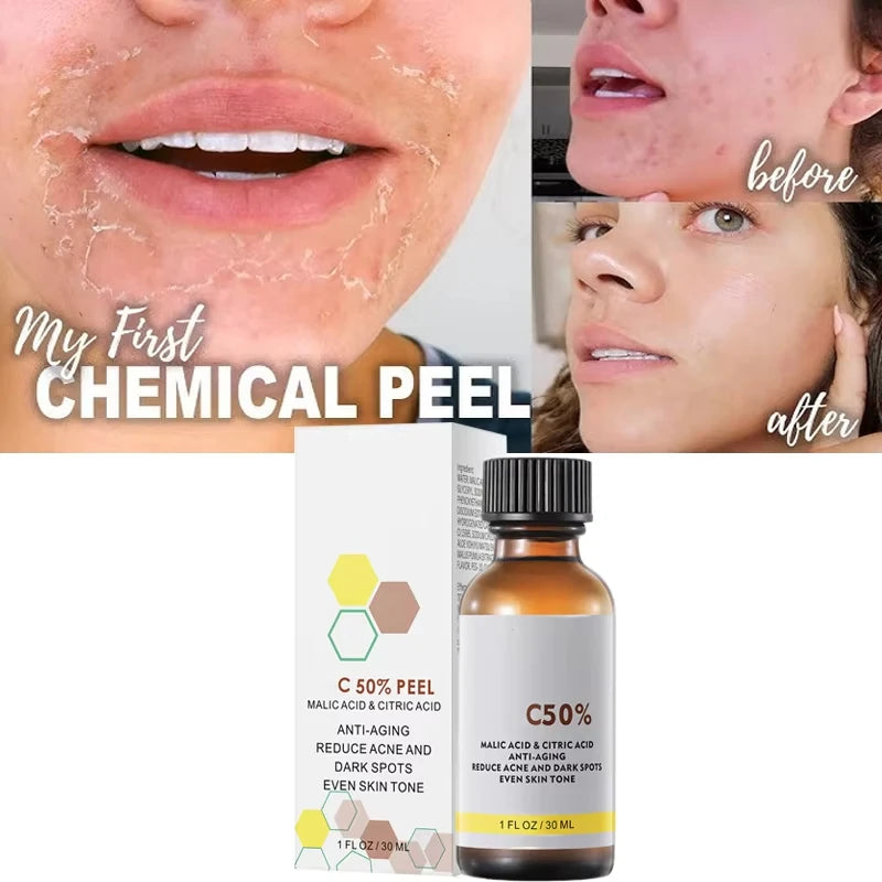 Face Care Exfoliating Radiant Skin Fade Dark Spots & Pigmentation for Even Brighter Skin Remove Spots Arm Knee Legs Melanin